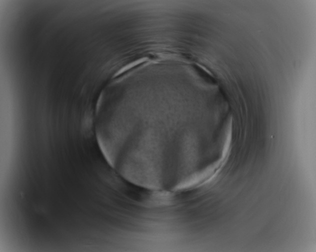 X0000094340144200711162017