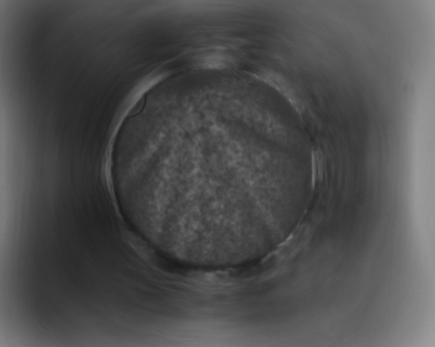 X0000094340147200711162017