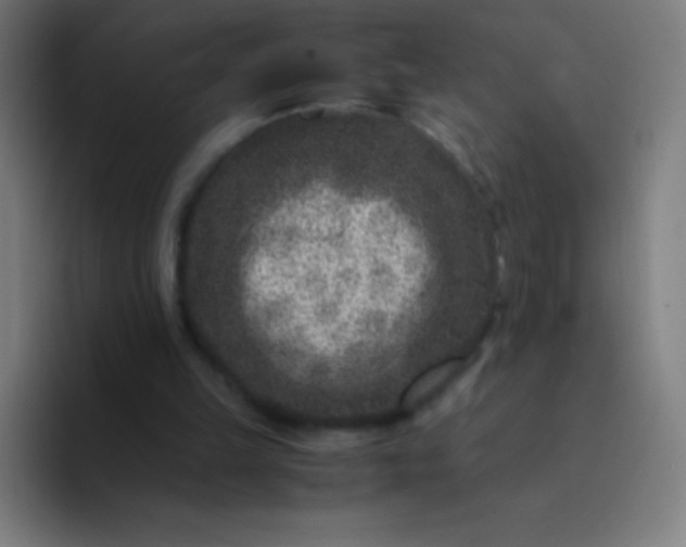 X0000094340149200711162017