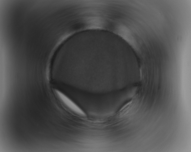 X0000094340156200711162017