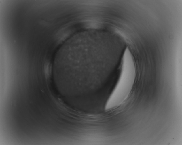 X0000094340168200711162017