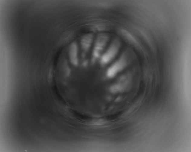 X0000094340169200711162017