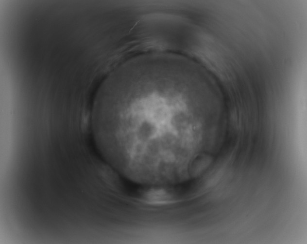 X0000094340177200711162017