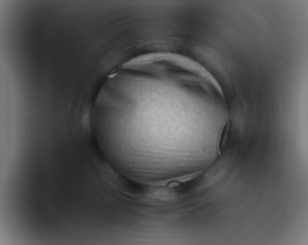 X0000094340185200711162017