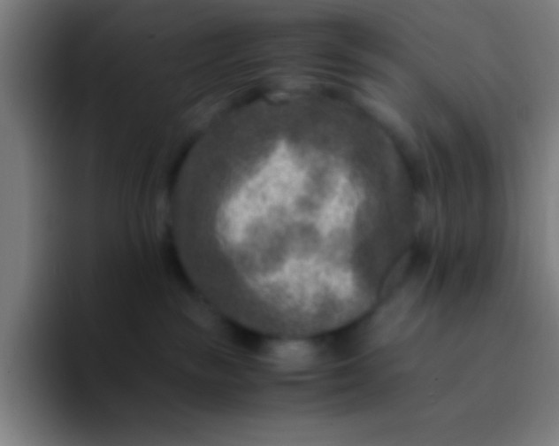 X0000094340189200711162017