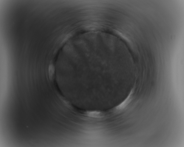 X0000094340192200711162017