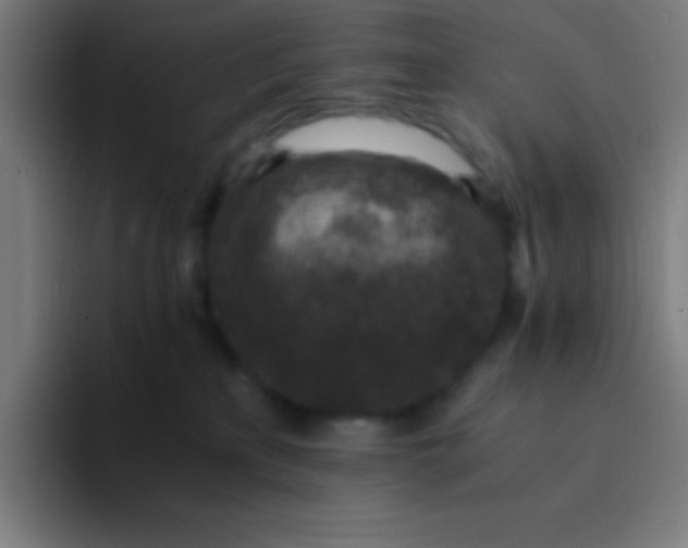 X0000094340233200711162016