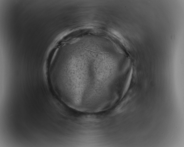 X0000094340244200711162015