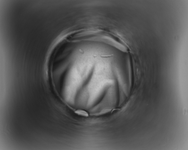 X0000094340246200711162015