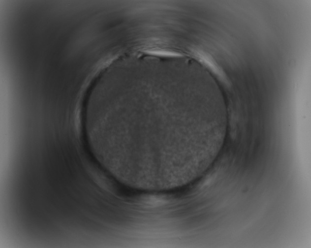 X0000094340250200711162015