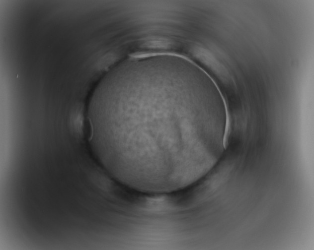 X0000094340309200711162015