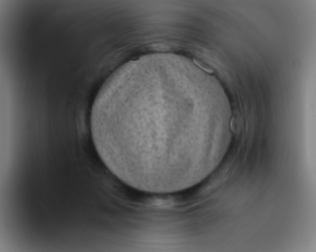 X0000094340317200711162015