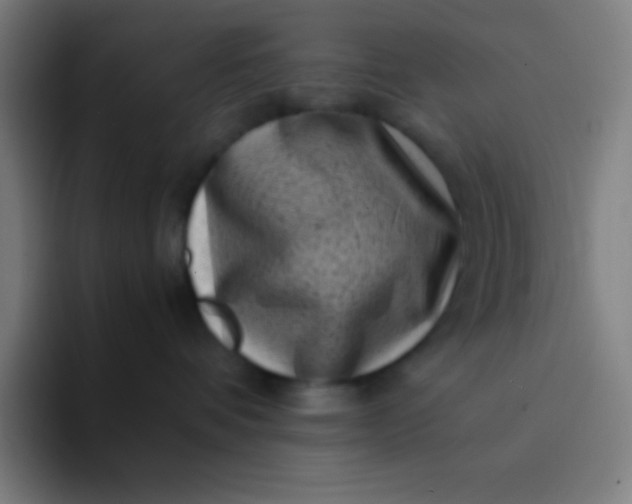 X0000094340336200711162015