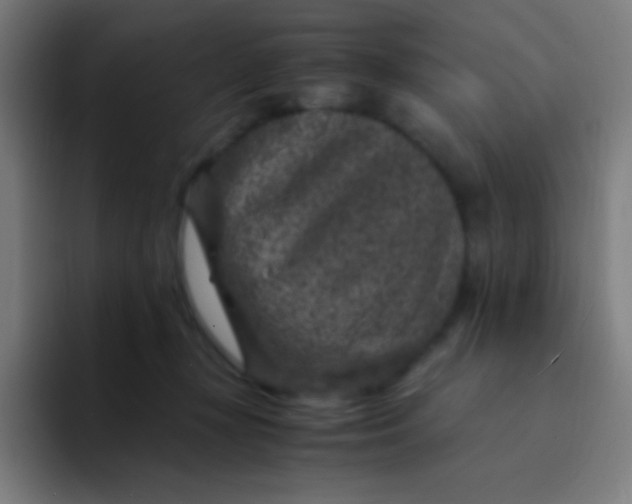 X0000094340367200711162014