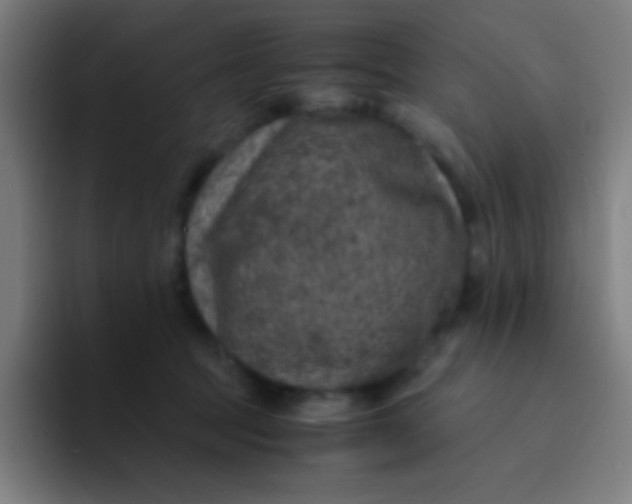 X0000094340369200711162014