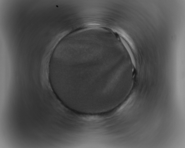 X0000094340385200711162014