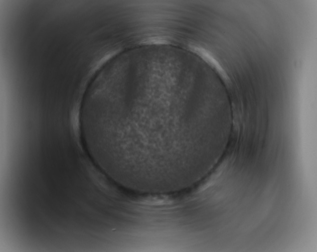 X0000094340386200711162014