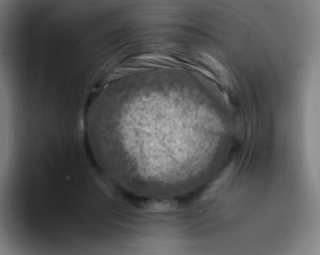 X0000094340405200711162014