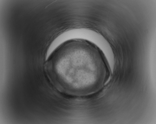 X0000094340416200711162014