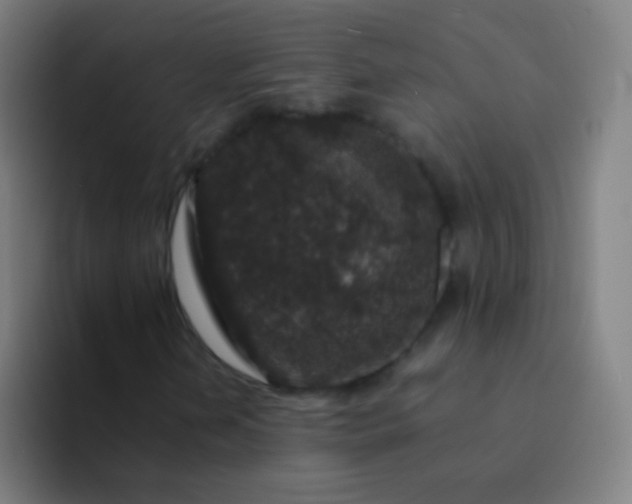 X0000094341202200711162003