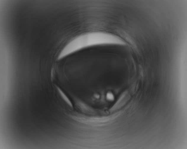 X0000094350027200711162039