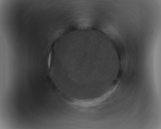 X0000094350041200711162039