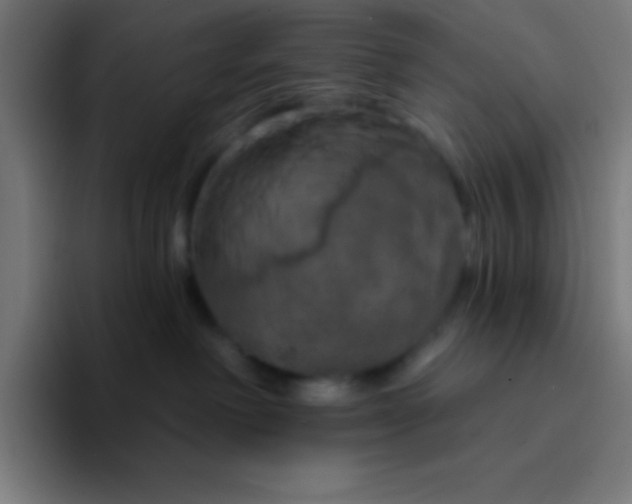 X0000094350238200711162036