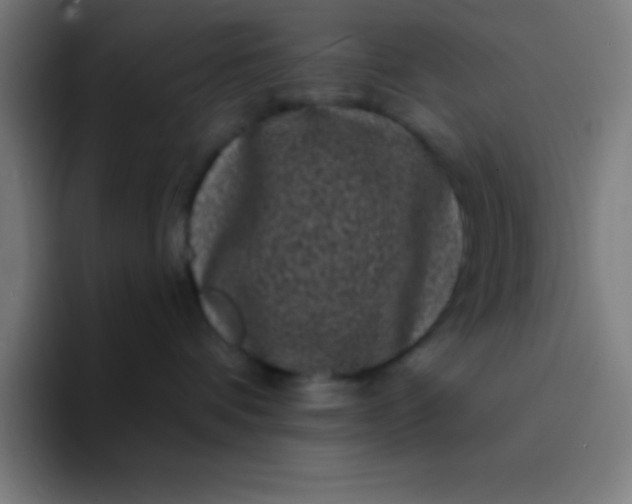 X0000094350336200711162035