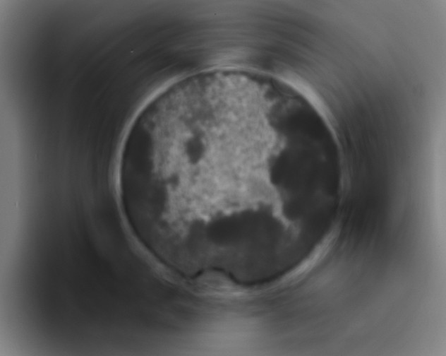 X0000094350957200711162027