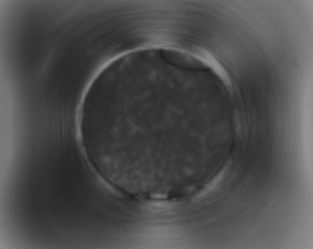 X0000094351102200711162025