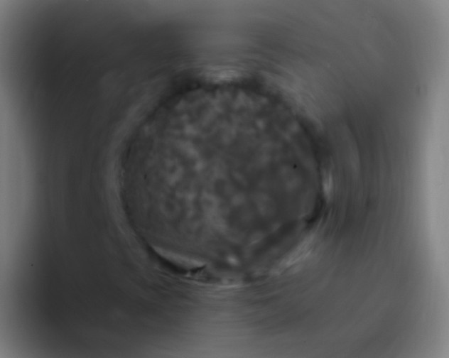 X0000094351393200711162020