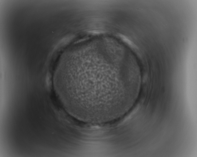 X0000094351398200711162020