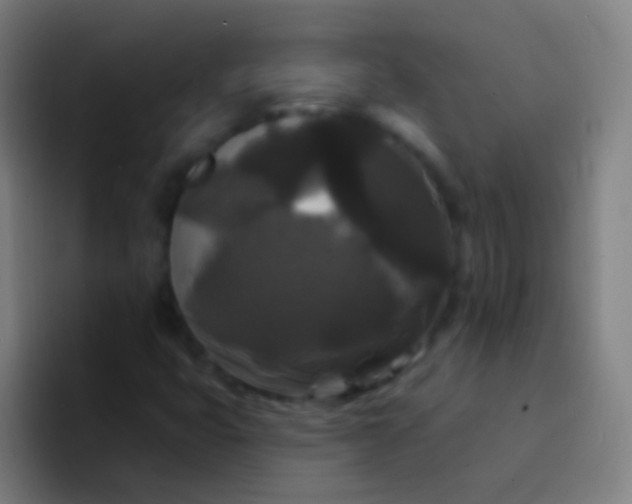 X0000094351399200711162020