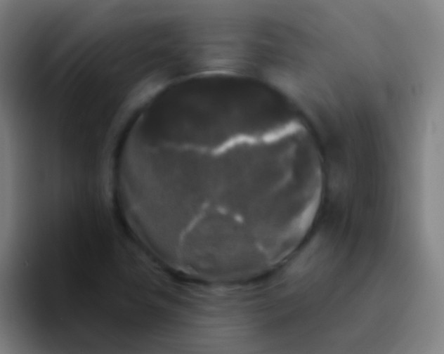 X0000094351411200711162021