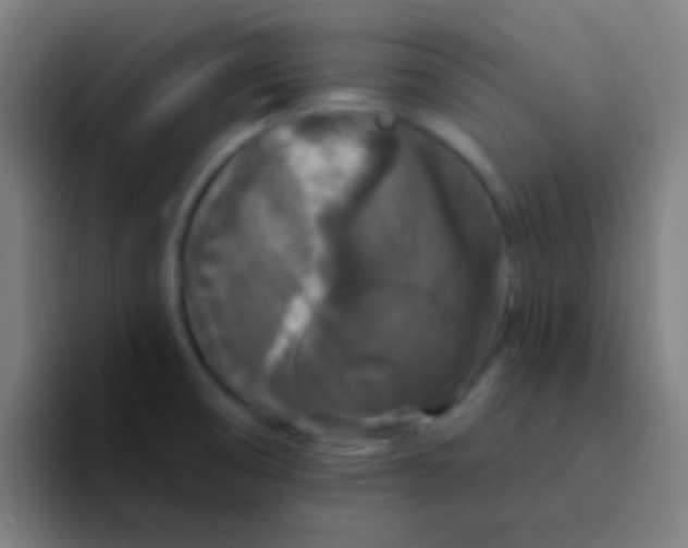 X0000094351474200711162020