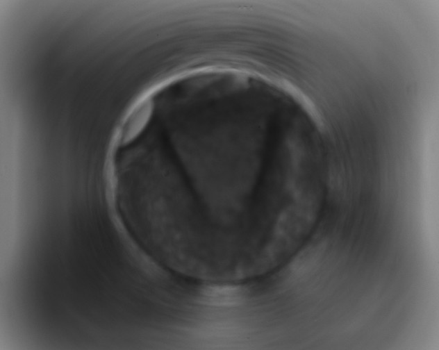 X0000094351522200711162019