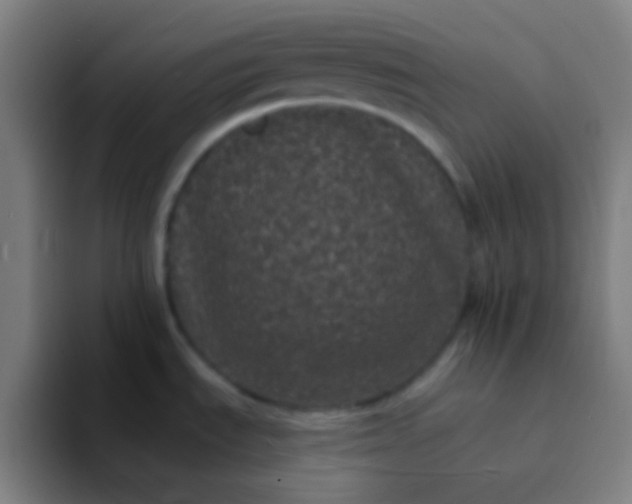 X0000094351535200711162020