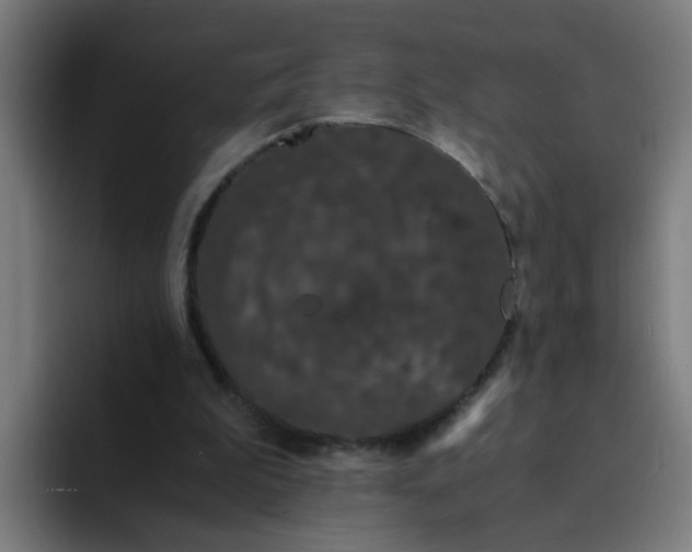 X0000094360199200711162057