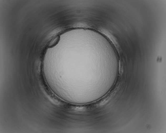 X0000094360157200711241945