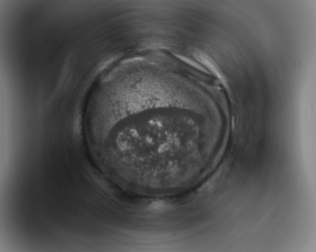 X0000094380249200711162136