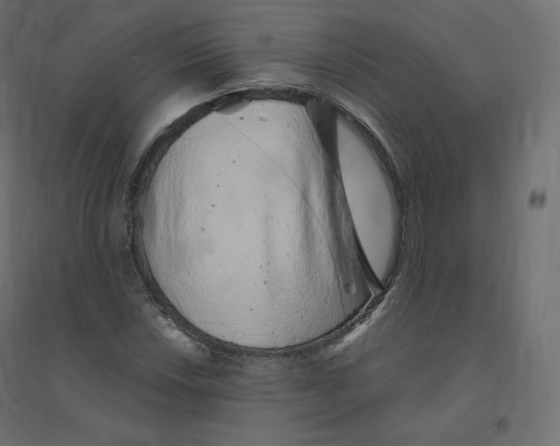 X0000094381018200711242017