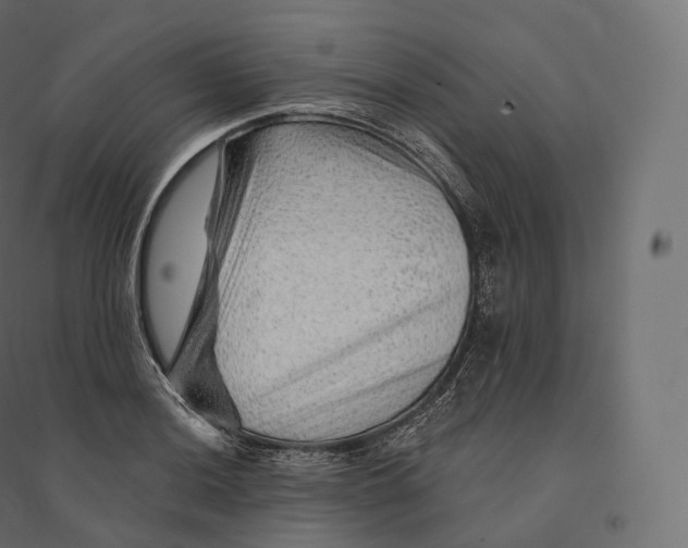 X0000094381036200711242017