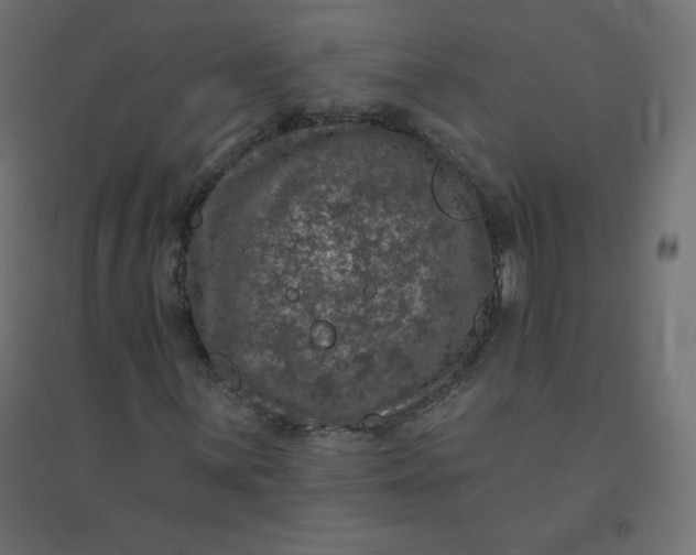 X0000094381059200711242017