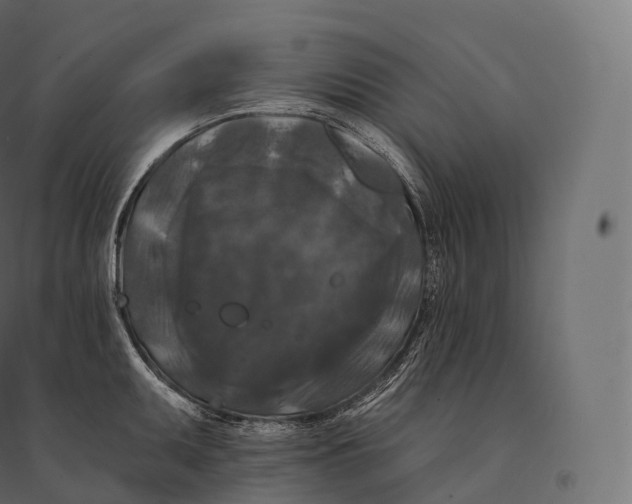 X0000094381095200711242017