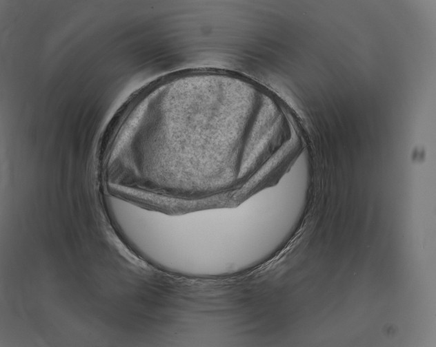 X0000094381116200711242016