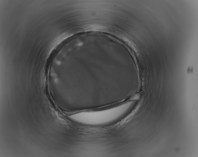 X0000094381117200711242016