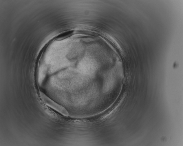 X0000094381138200711242016