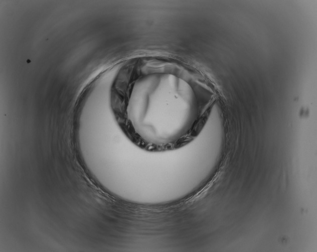 X0000094381165200711242015