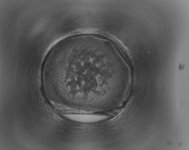 X0000094381174200711242015