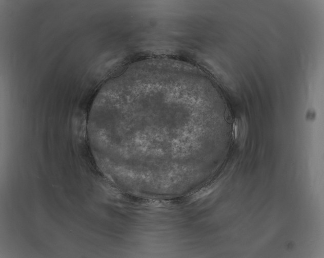 X0000094381251200711242014